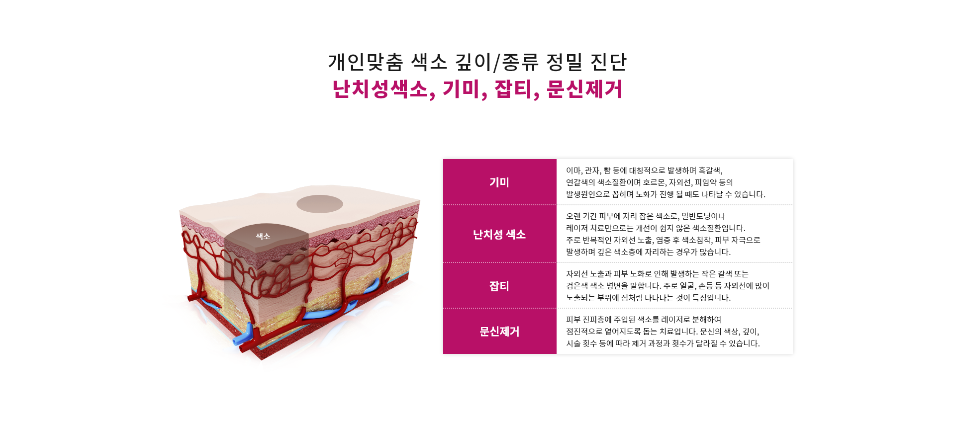 개인맞춤 색소 깊이/종류 정밀 진단