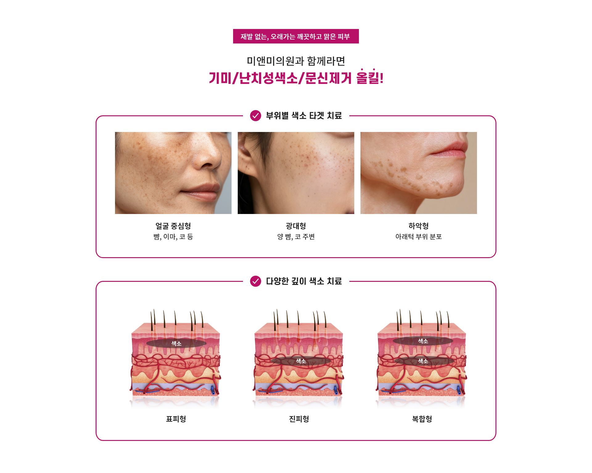 미앤미의원과 함께라면 기미/난치성색소/문신제거 올킬!