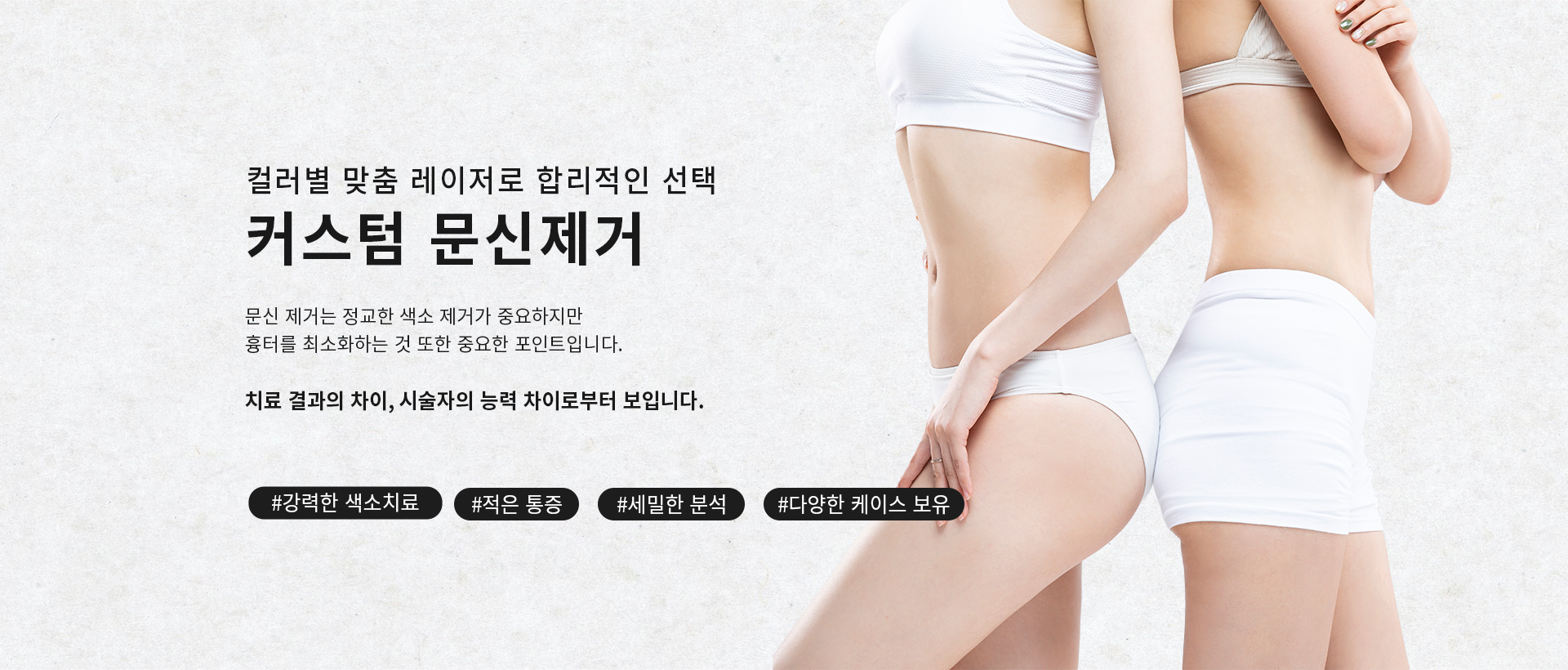 커스텀 문신제거