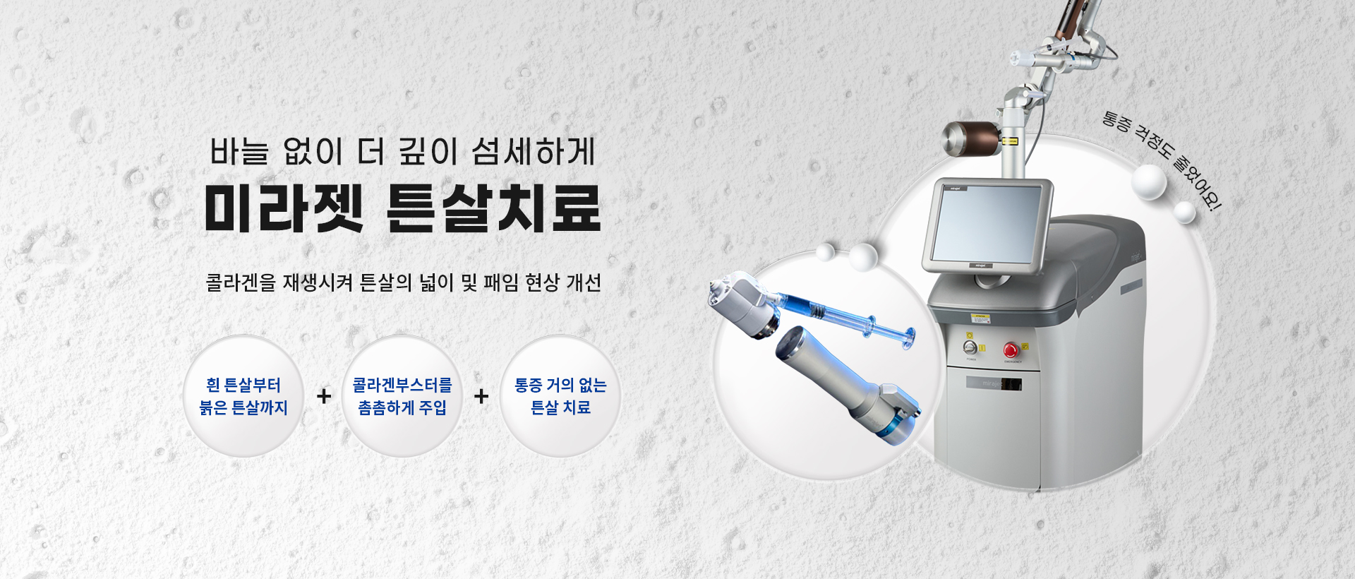 튼살치료
